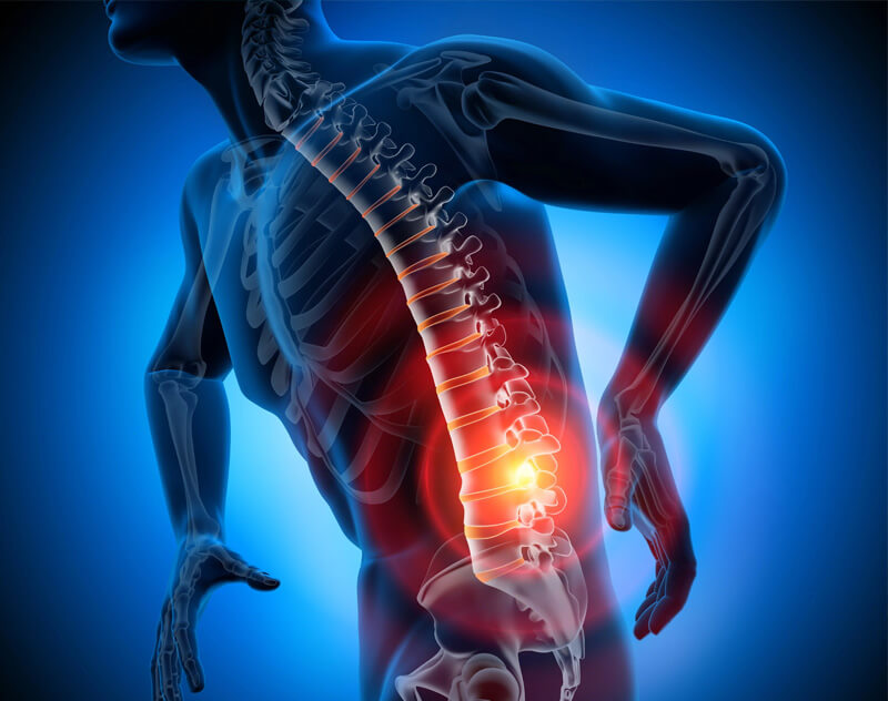 Graphical image of a man showing as xray with a focus on inflammation of spine