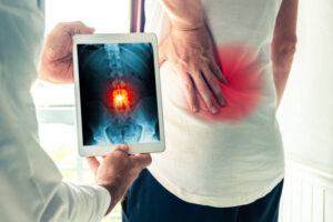 Spinal Decompression Bakersfield CA, Paragon Surgery, Disk Extrusion Treatment, Herniated Disc Treatment New Port, Paragon Pain Management